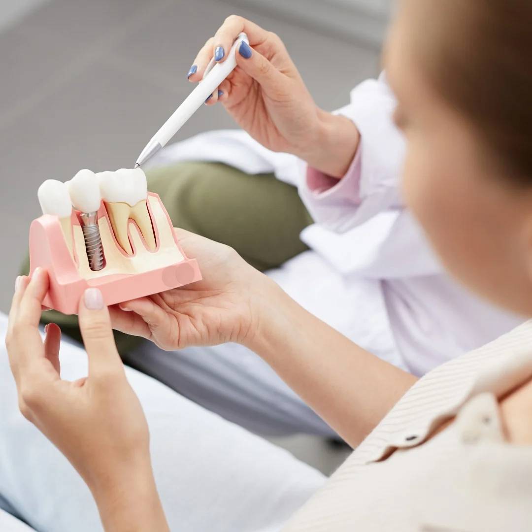 Dental Implants London ON