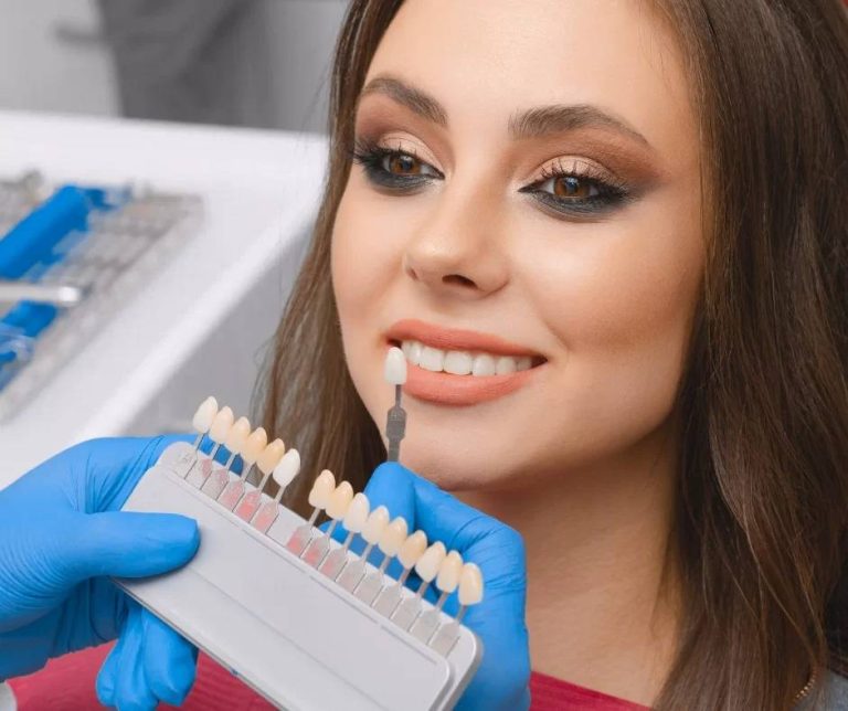 teeth whitening near me London ON