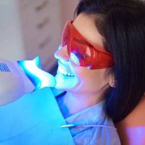 veneers vs teeth whitening