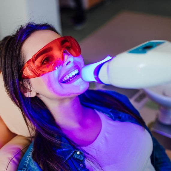 Teeth Whitening