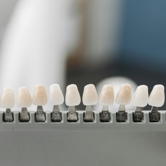 Veneers