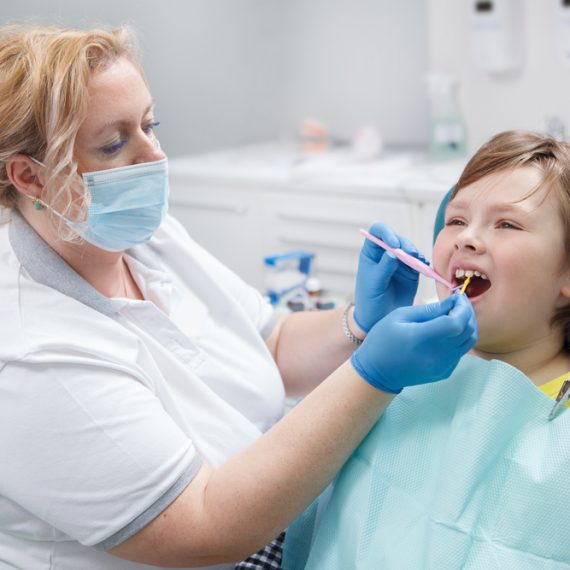 Fluoride Treatments